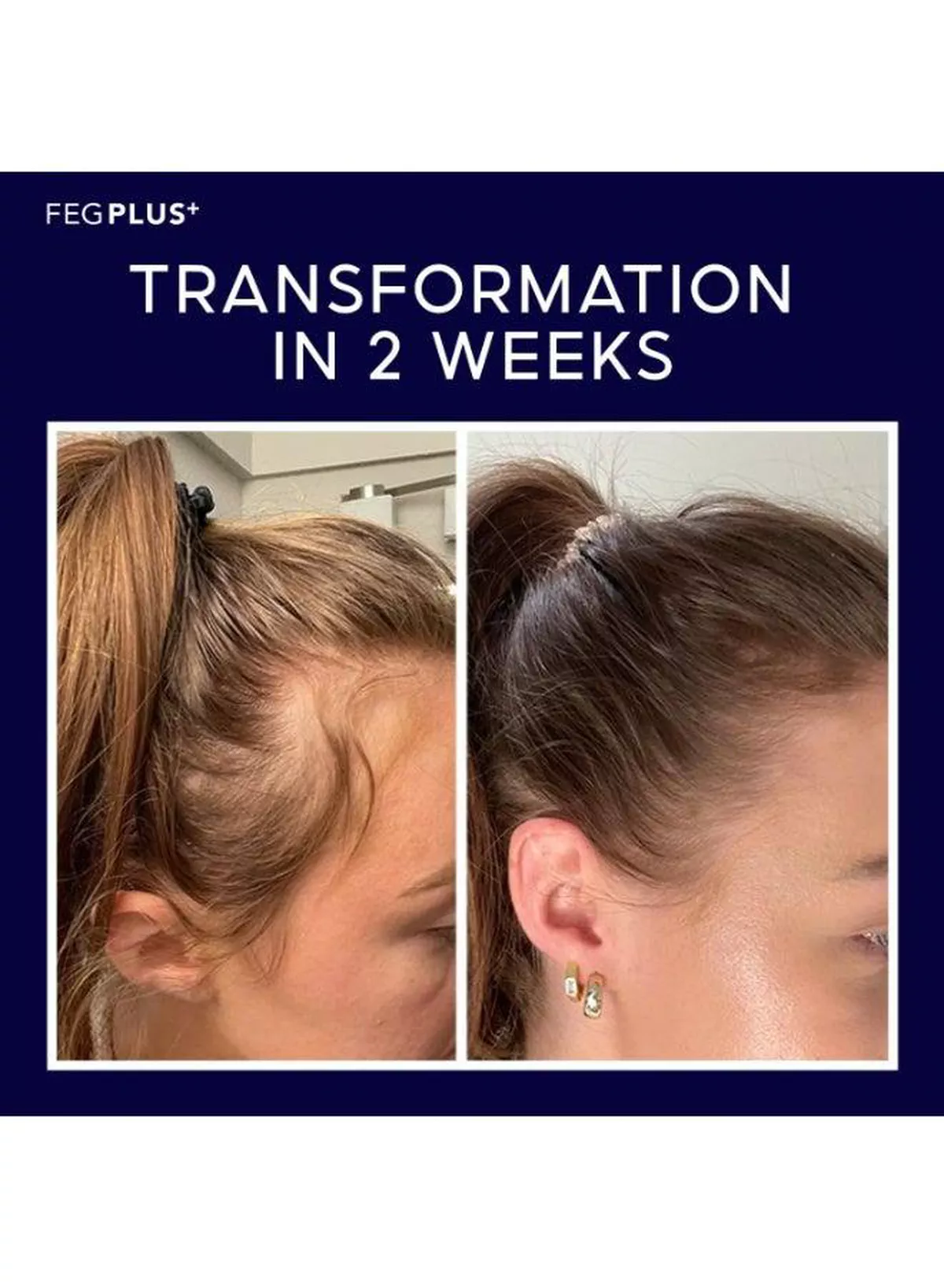 FEG PLUS Natural Hair Care Spray FEG PLUS combines selected hair-care ingredients with Apple Stem Cells and Redensyl 5% in a convenient spray formula, making it an easy addition to your everyday hair-care routine.-8-8