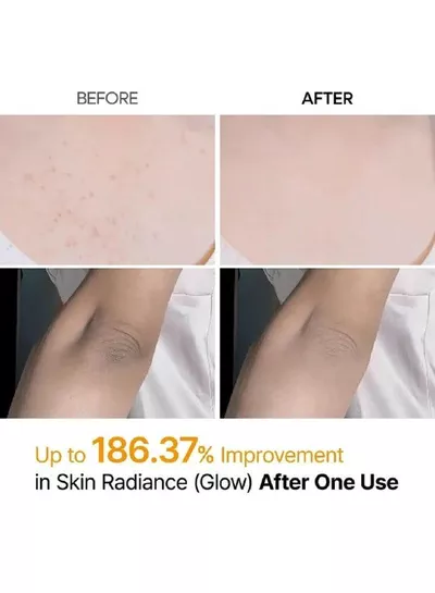 Dr. Melaxin Peel Shot Body and Foot Exfoliating Spray with Kojic Acid, Turmeric and Niacinamide 200ml – Daily Skin Refining Care for Dull, Rough-Looking Areas and a Softer, Smoother, More Radiant Appearance-5