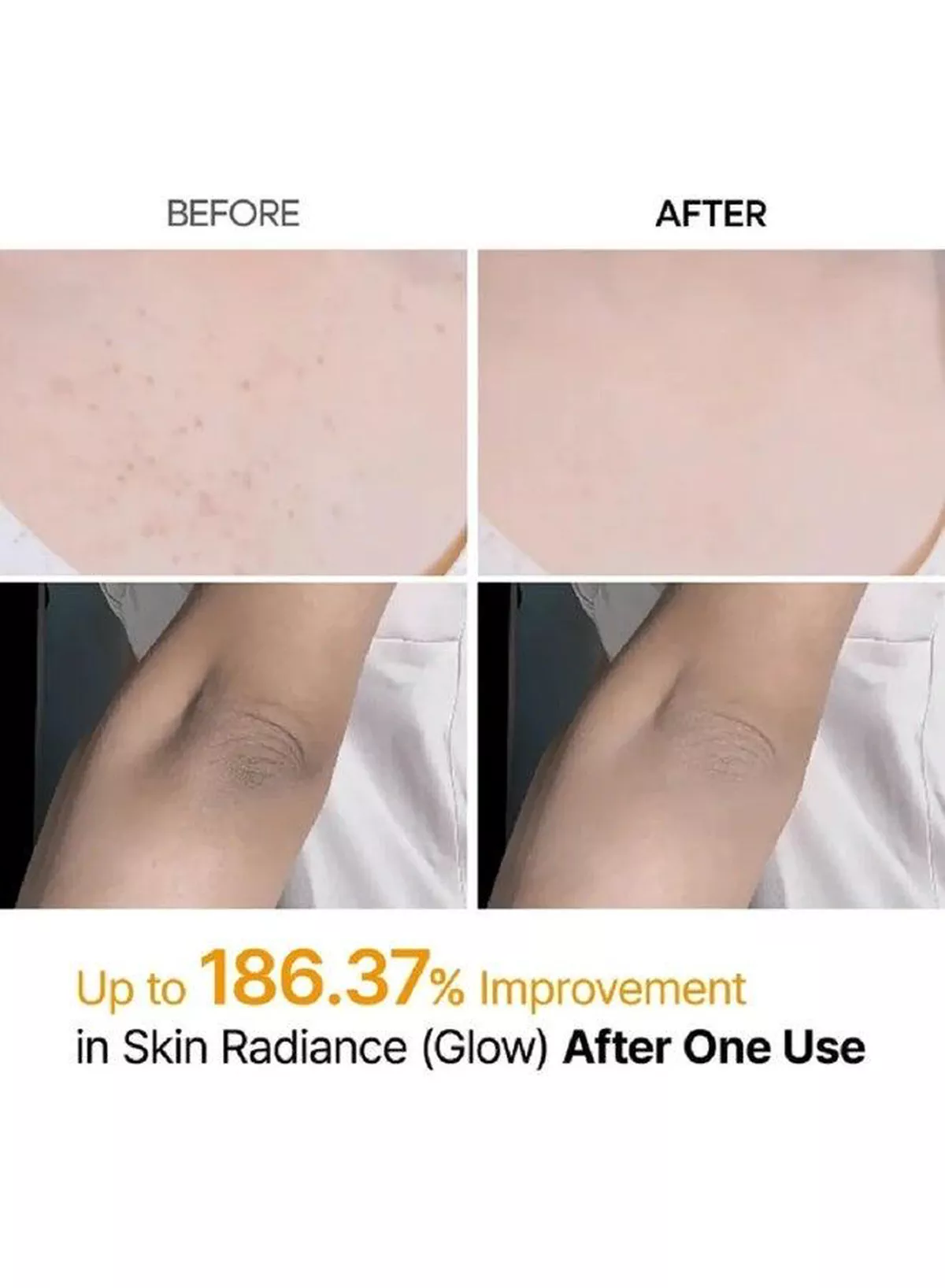 Dr. Melaxin Peel Shot Body and Foot Exfoliating Spray with Kojic Acid, Turmeric and Niacinamide 200ml – Daily Skin Refining Care for Dull, Rough-Looking Areas and a Softer, Smoother, More Radiant Appearance-5-5