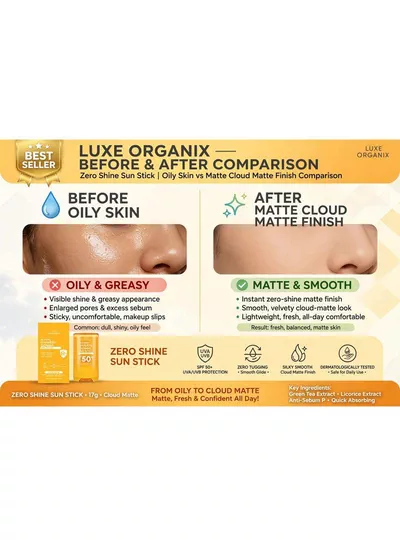 Luxe Organix Zero Shine Sun Stick SPF 50+ PA++++ – 17g A travel-friendly sunscreen essential featuring SPF 50+ protection, UVA/UVB defense, zero shine, quick absorption, and a silky matte finish, making it ideal for effortless daily sun protection and reapplication.-6