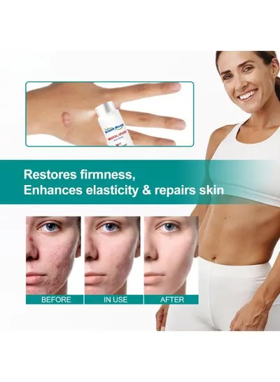 South Moon Scar Care Spray 20g – Medical Grade Skincare Spray for Convenient Daily Application, Designed to Support Skin Renewal and Help Improve the Visible Appearance of Different Types of Scars-3